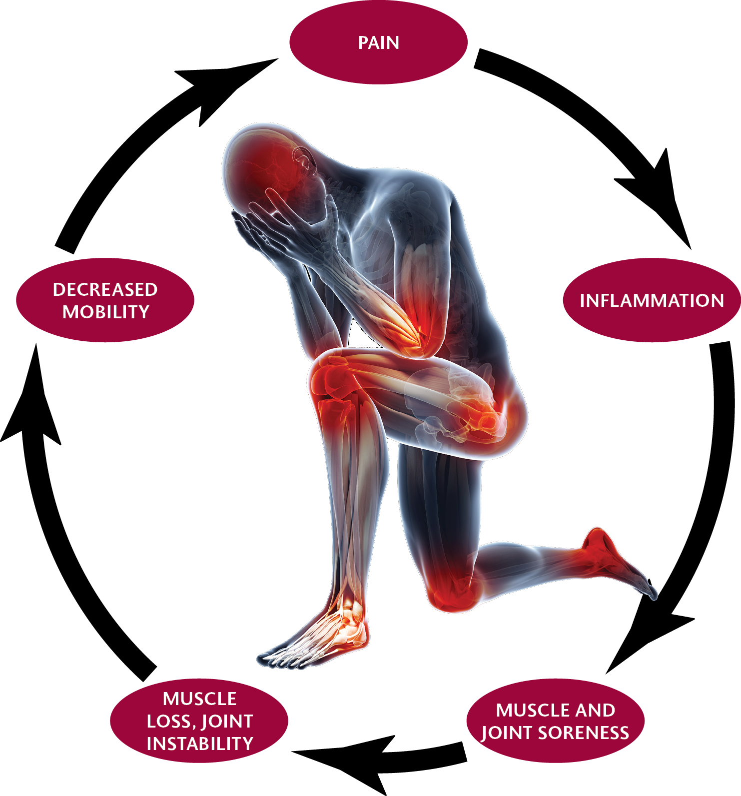 Pain Cycle